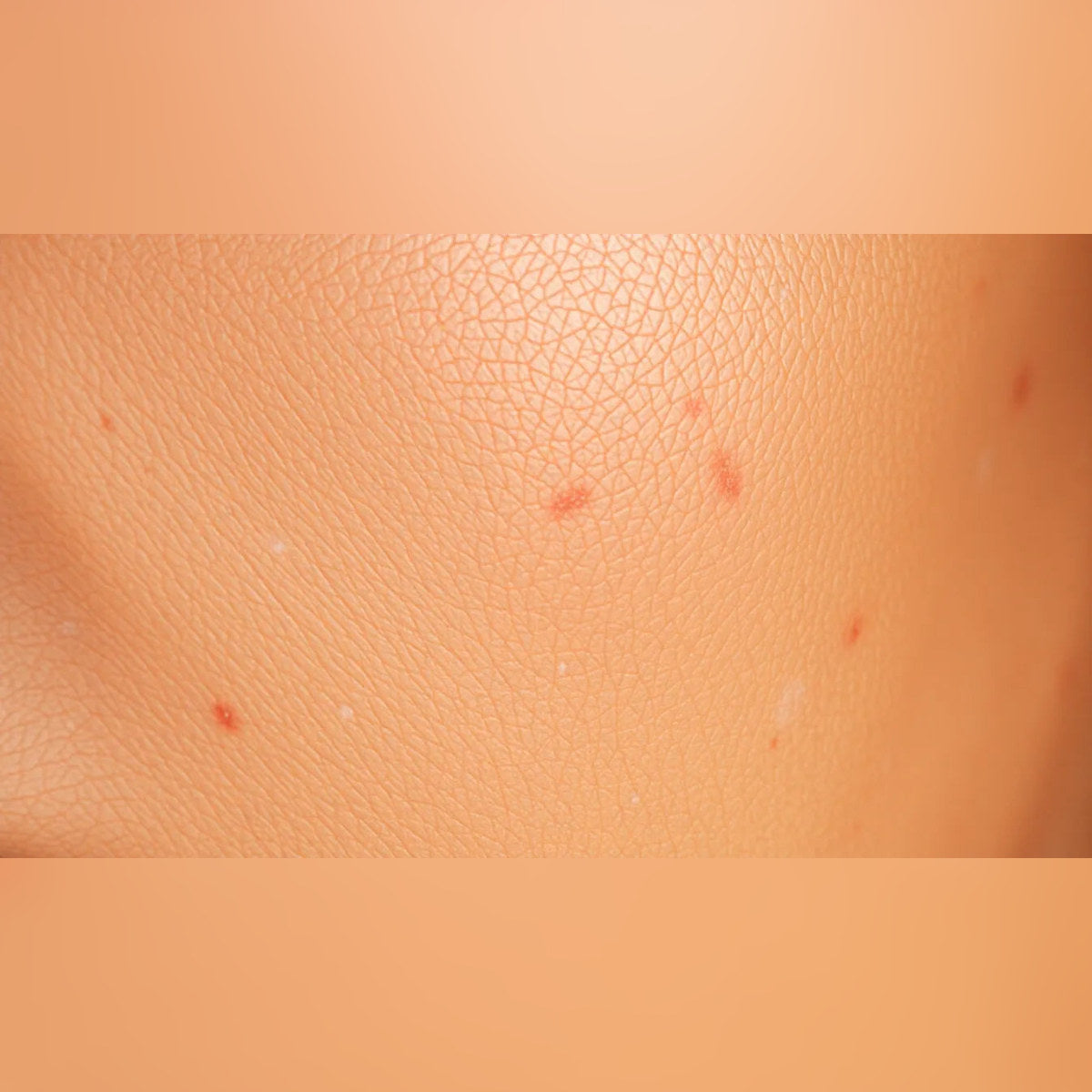 5 Powerful Ingredients for Skin Pigmentation
