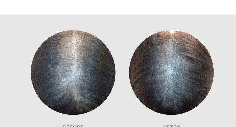 EXO-GROW progress example after 1 treatment and homecare